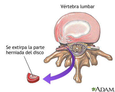 Imagen de resonancia magnetica lumbar